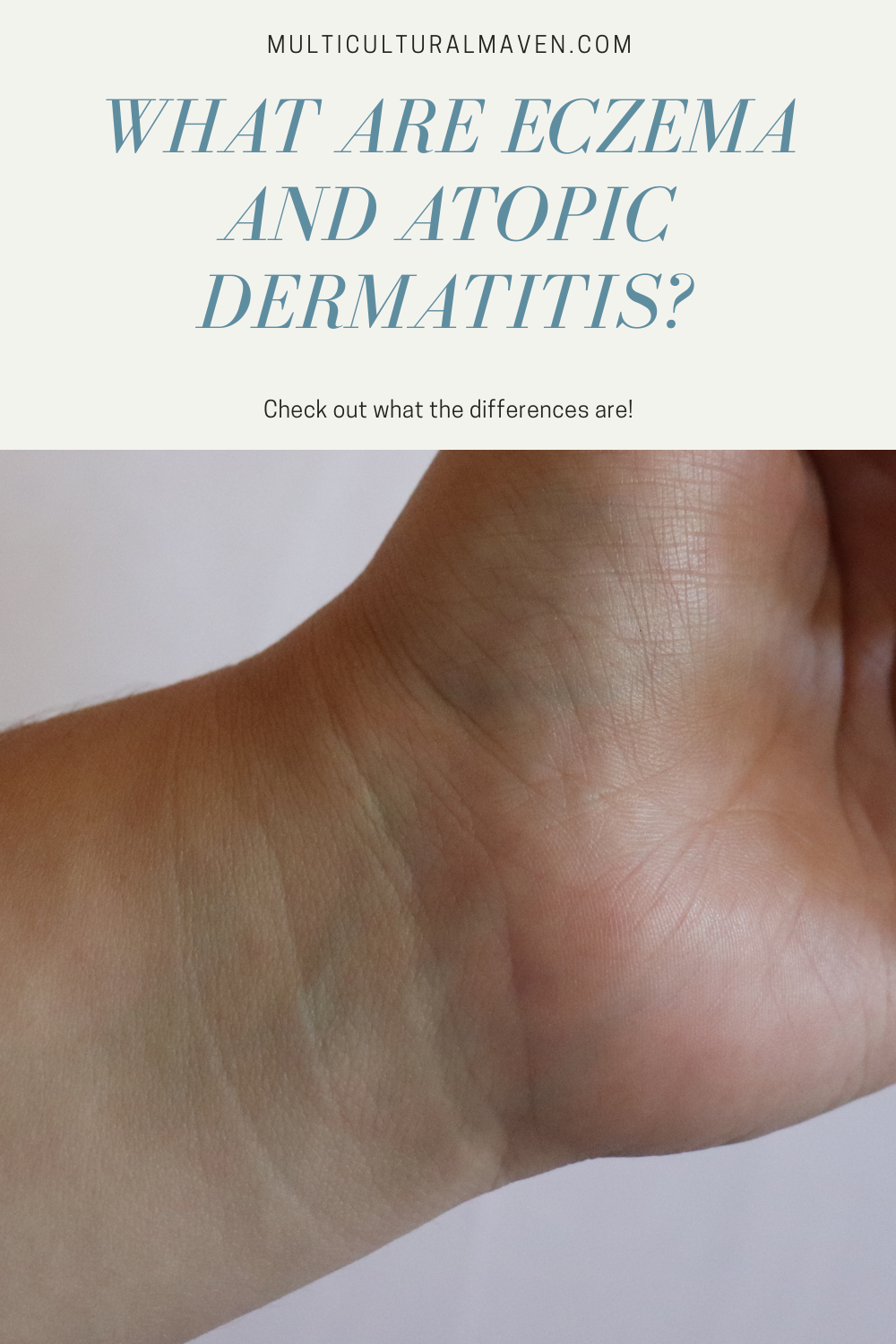 What are eczema and atopic dermatitis?